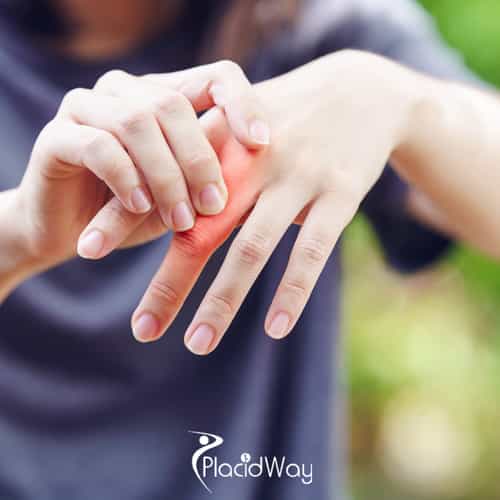 How Stem Cells Are Helping U.S. Patients Find Lasting Relief from Rheumatoid Arthritis